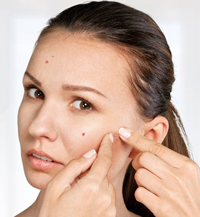 accutane help to stop acne